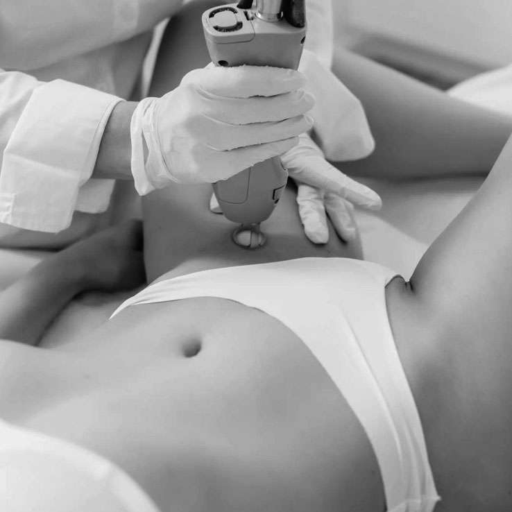 Laser Treatment