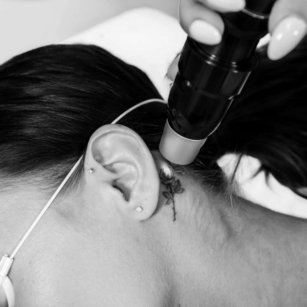 Woman having tattoo removed